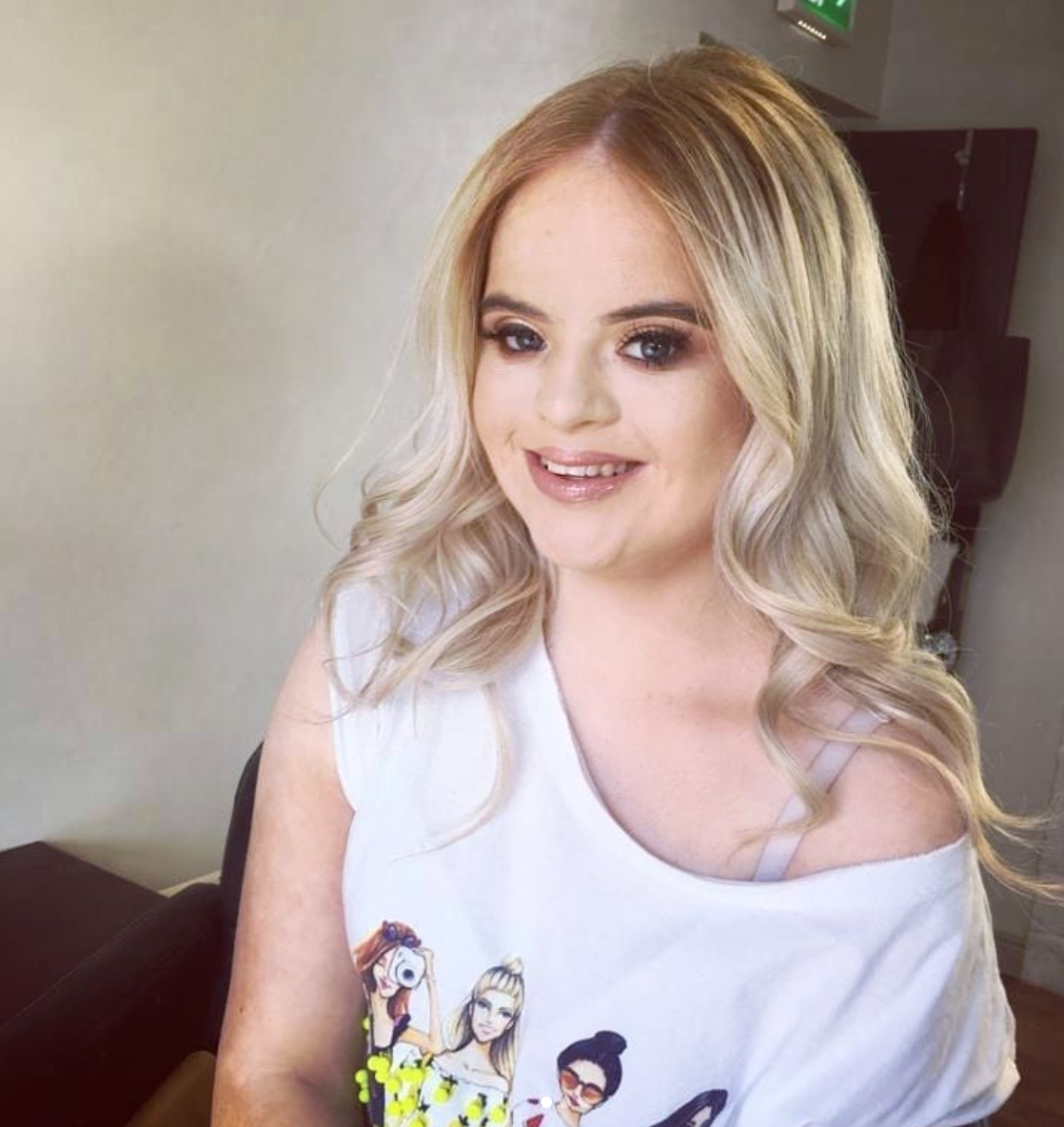 Do mắc bệnh nên Kate Grant từng nộp nộp hồ sơ thi tuyển vào nhiều công ty đào tạo người mẫu nhưng đều bị từ chối nhưng cô nàng chưa bao giờ nhụt chí, vẫn cố gắng không ngừng.