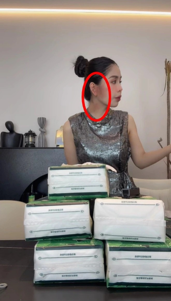 Cách đây ít ngày, Hằng Du Mục xuất hiện trên live trong tình trạng mặt và tay có những vết bầm lớn khiến netizen lo lắng. Chồng của cô cùng đã thừa nhận cả 2 có sự xô xát.