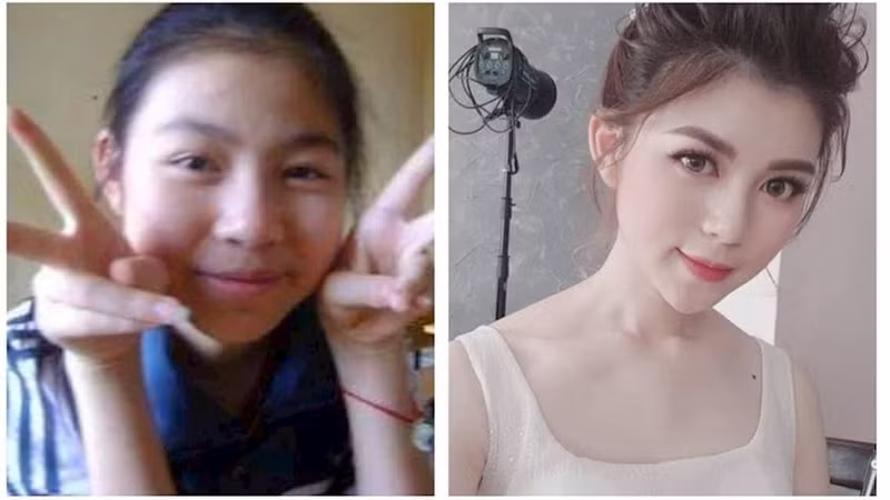 Thế nhưng, với màn dậy thì không thể thành công hơn, cô nàng trở nên xinh đẹp hút hồn với nước da trắng bóc và ngũ quan hài hoà. Phương Anh cho biết điều quan trọng để sở hữu một ngoài hình xinh đẹp hơn là có chế độ ăn uống hợp lý, biết tự chăm sóc và yêu thương bản thân.