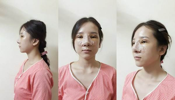 Thời điểm còn chưa thẩm mỹ, ngoại hình của Hà luôn là chủ đề bàn tán của những người xung quanh. Dù cố gắng học hành chăm chỉ ở trường Y 6 năm trời, luôn ngoan ngoãn lễ phép những cô vẫn không có được thiện cảm từ những người xung quanh.