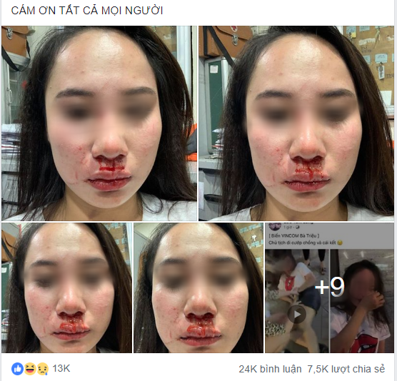 Ngay sau đó, "tuesday" đã lên tiếng kêu oan trên mạng xã hội đồng thời chụp lại bằng chứng việc bị hành hung nhưng không nhận được sự thương cảm, thậm chí còn phải gánh trọn gạch đá.