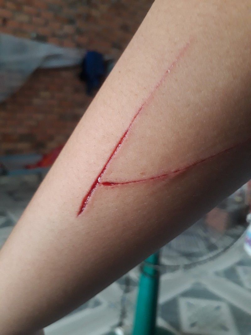 Vu tuoi 14 giam dinh thanh 17: Loi khai bat ngo cua be gai