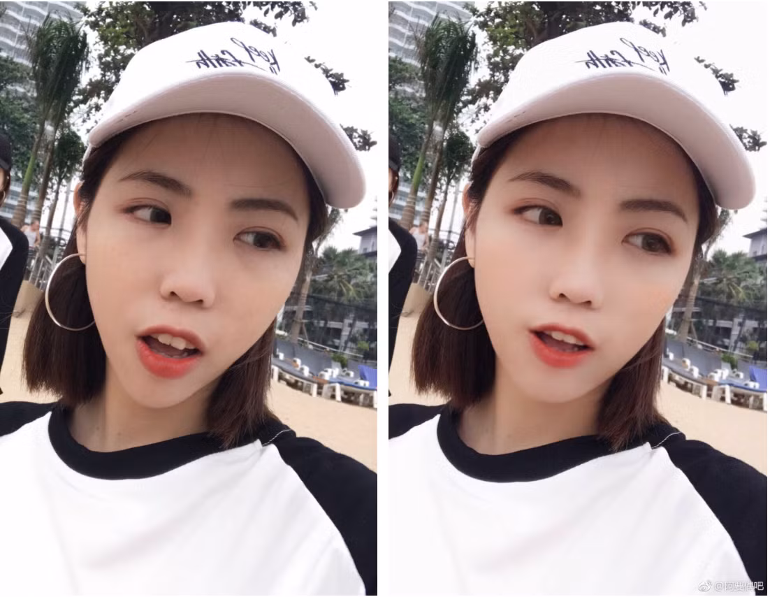 Răng hô cũng sửa được hết mà chẳng cần đi nha sĩ nha.