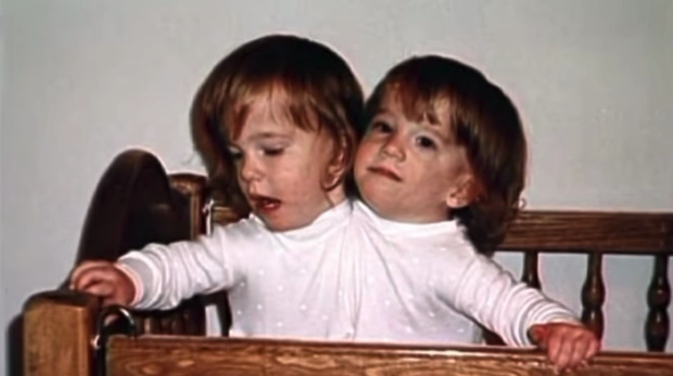 Thế nhưng như một phép màu, cả 2 vẫn lớn lên và phát triển như những đứa trẻ bình thường.