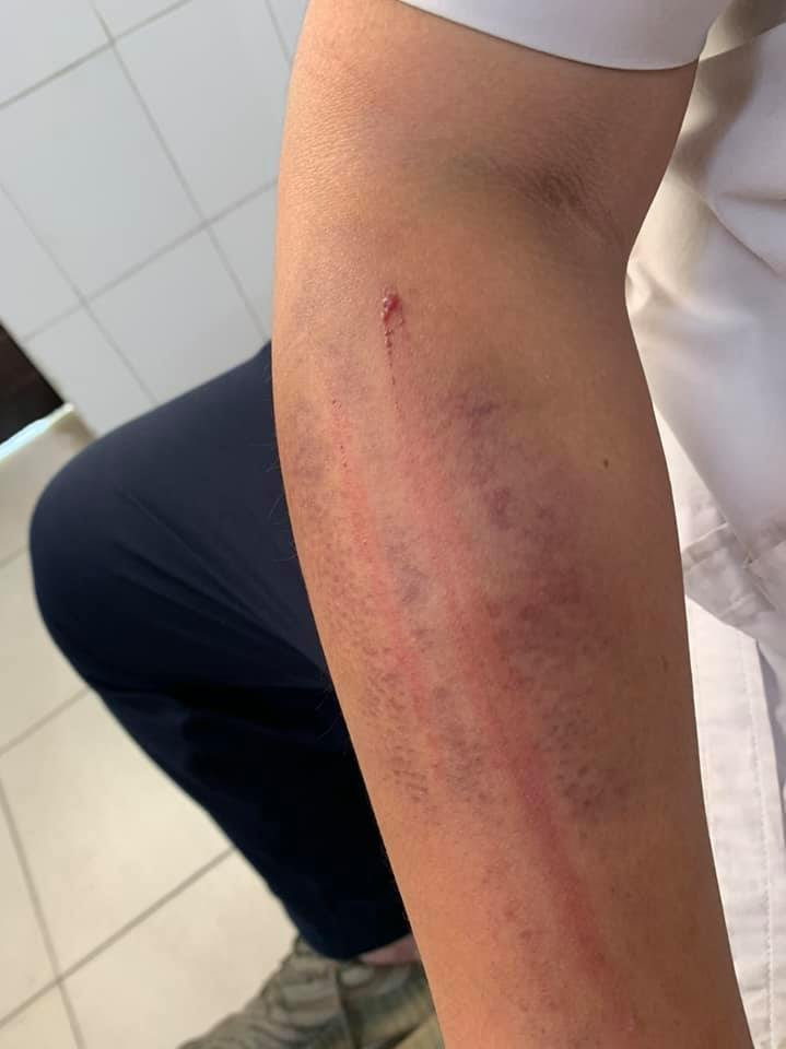 Dan mang buc xuc voi ong bo danh con nhu ke thu vi 