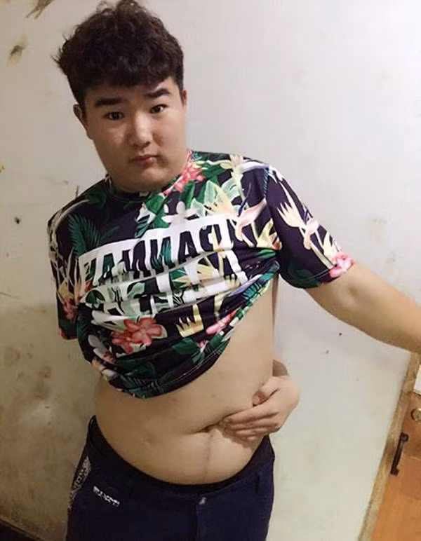 Mặc dù có khá nhiều người khó khăn khi thực hiện thử thách nhưng anh chàng với chiếc bụng bia này có thể hoàn thành màn chạm rốn một cách dễ dàng khiến nhiều người hoài nghi "kết luận khoa học" của thử thách chạm rốn.