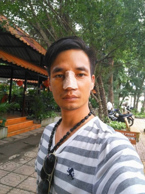 Sau khi trở thành hiện tượng mạng, Lệ Rơi được săn đón. Không chỉ còn hát cho vui nữa, anh chàng nuôi tham vọng lấn sân vào showbiz khi tham gia gameshow, đi diễn, đóng phim...