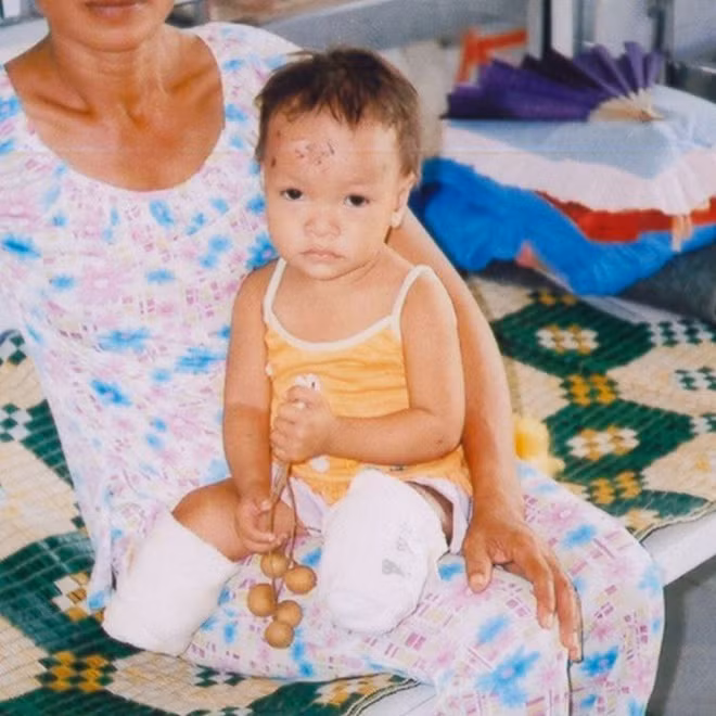 Nhờ đó, Haven không bao giờ cảm thấy xấu hổ vì đôi chân không lành lặn. 10X nói cô may mắn khi được sống theo cách mình muốn.