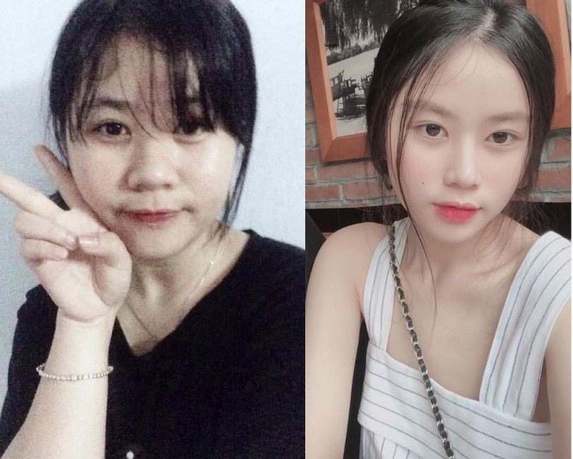 Nhìn ảnh này chẳng ai nghĩ đây là một người đâu nhỉ? Giản cân xong cả khuôn mặt, mũi,...đều thay đổi hẳn. Chưa kể đến việc có thân hình ưa nhìn, ăn mặc đẹp hơn chắc chắn sẽ bắt mắt hơn.