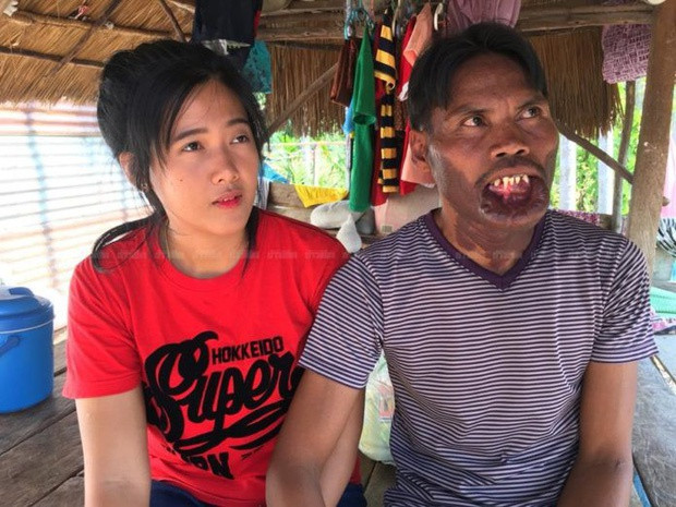 Khi mới về chung một nhà với Khantong, Raknak thường xuyên bị chồng cũ làm phiền, đặt điều rằng cô kết hôn với chàng trai xấu xí chỉ vì tiền. Sau đó, Raknak phải lên tiếng giải thích gia cảnh Khantong không hề giàu có như đồn đại. Sau 1 năm kết hôn, Raknak - Khantong liên tục chia sẻ hình ảnh hạnh phúc, đầm ấm lên trang cá nhân khiến nhiều người ngưỡng mộ.