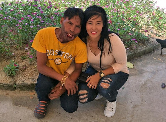 Năm 2018, đám cưới của cặp đôi Patras Raknak và Boonmee Khantong ở Changwat Songkhla (Thái Lan) thu hút sự chú ý của dân mạng châu Á. Bởi trong khi Raknak sinh năm 1995, có ngoại hình ưa nhìn, thì Khantong lại kém sắc, bị dị tật ở môi và hơn vợ 11 tuổi. Trước mối tình này, Raknak có 1 đời chồng và con gái nhỏ. 9X nhận xét dù Khantong khiếm khuyết về ngoại hình, anh rất hiền lành, chịu khó và chăm lo cho 2 mẹ con cô.