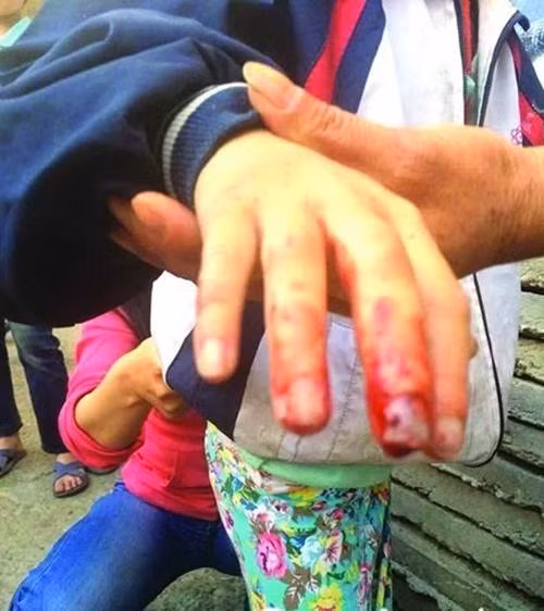 Những hình ảnh Đồng Đồng, một cô nhóc 7 tuổi, đang học lớp 2 bị cha ruột và mẹ kế bạo hành dã man đang khiến cho cộng đồng mạng Trung Quốc hết sức phẫn nộ.