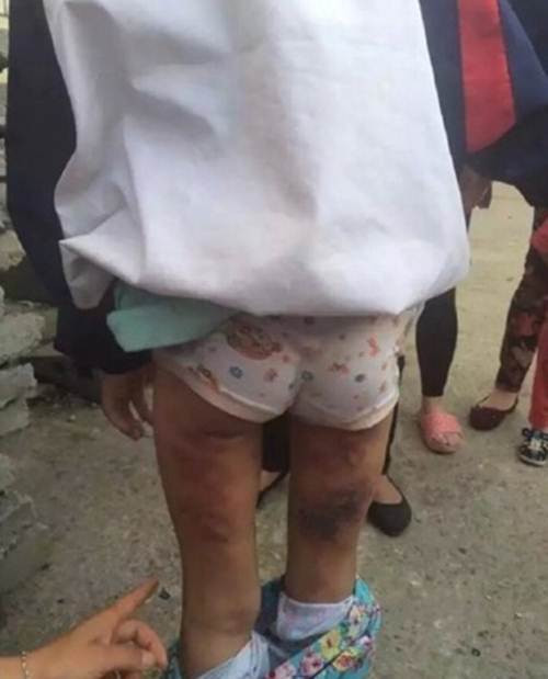 Người hàng xóm này cũng chia sẻ thêm, thường xuyên nghe thấy tiếng quát mắng, đánh đập từ phía nhà của Đồng Đồng, không biết vì sao cô bé rất hay bị đánh đập, mẹ kế đánh, cha ruột cũng ra sức đánh. Trước đây Đồng Đồng có ông bà bảo vệ, từ sau khi bố mẹ ly dị, bố tái hôn, cuộc đời của Đồng Đồng chịu nhiều đắng cay, khổ cực.