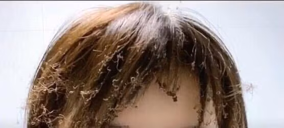 Cũng theo diễn đàn này, đây là hậu quả của việc trổ tài nấu nướng của cô gái. Chia sẻ này ngay lập tức thu hút được sự chú ý của dân mạng bởi gái đảm thì nhiều chứ vụng về như cô gái này thì mấy.