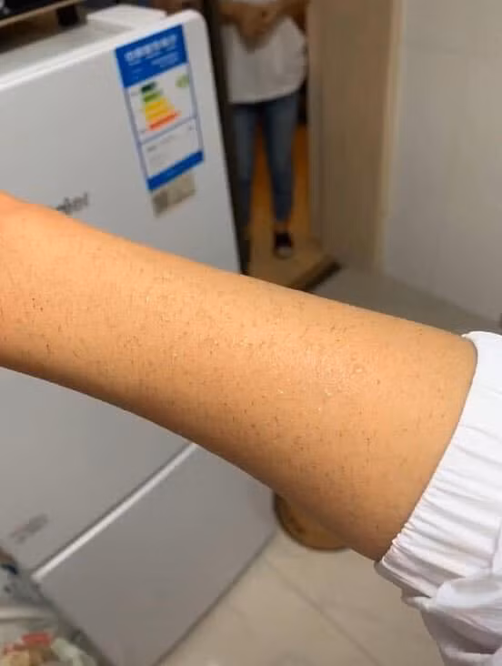 Không chỉ có tóc, lông tay của nhân vật cũng bị ngọn lửa thiêu rụi ngay từ lần đầu "trổ tài nấu ăn". Nhiều người thắc mắc tại sao lông mày cô gái lại còn nguyên vẹn?