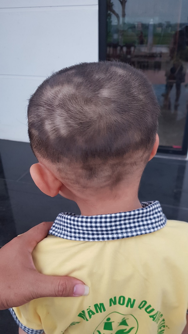 Cậu bé con hồn nhiên chẳng biết gì vẫn tung tăng diện mái tóc mới cắt đi chơi. Dù biết trẻ con nghịch ngợm, để chúng ngồi im cắt tóc là điều rất khó nhưng thế này thì quá thảm hoạ.