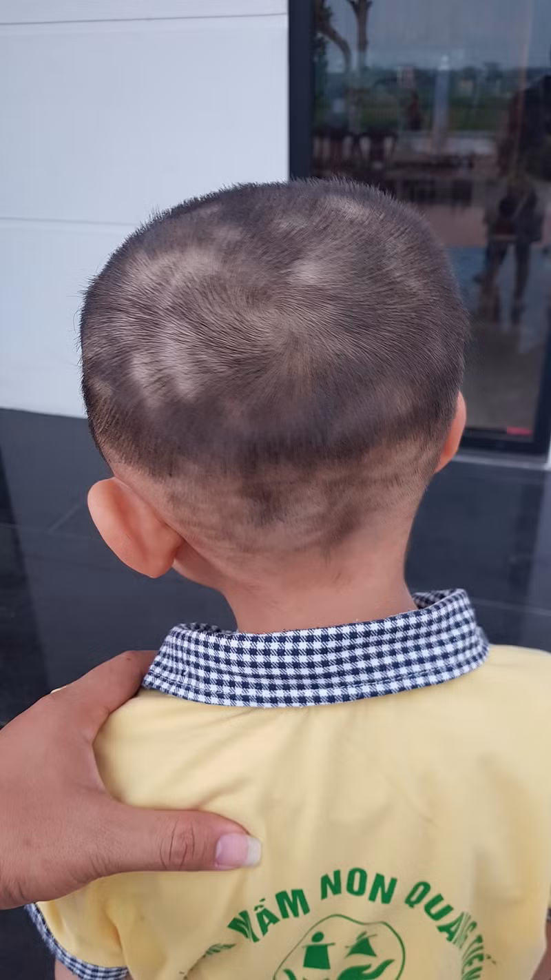 Cậu bé con hồn nhiên chẳng biết gì vẫn tung tăng diện mái tóc mới cắt đi chơi. Dù biết trẻ con nghịch ngợm, để chúng ngồi im cắt tóc là điều rất khó nhưng thế này thì quá thảm hoạ.