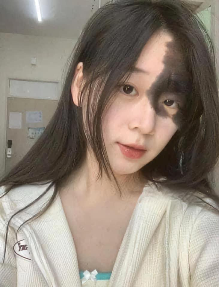 Tuy sở hữu vẻ ngoài khác lạ nhưng ngũ quan của cô rất hài hòa, xinh đẹp, sống mũi cao thẳng, đôi môi anh đào chúm chím.