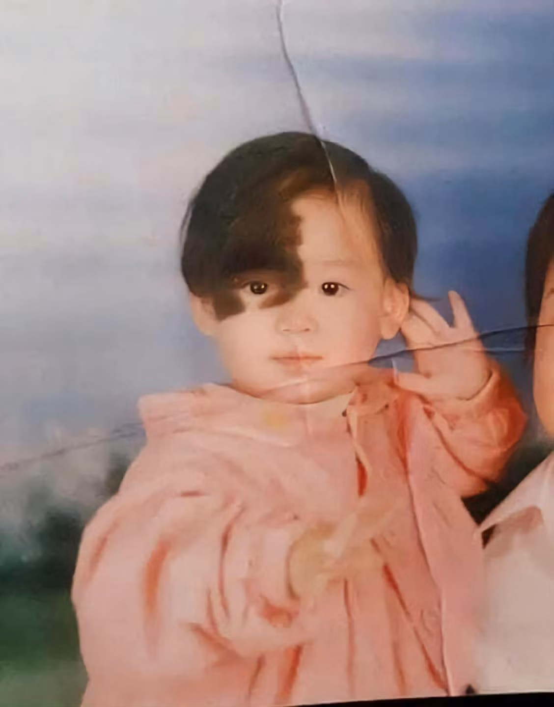 Từ bé, cô nàng này đã luôn gây chú ý bởi gương mặt với 2 màu da khác nhau.