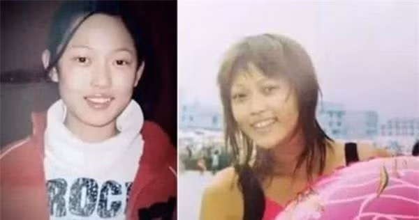 Hot girl phau thuat tham my nam 14 tuoi, tiet lo qua khu dong troi