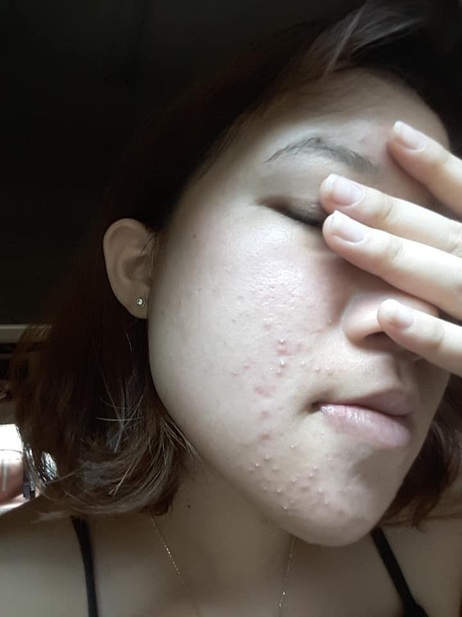 Bùi Thị Huỳnh Mai đến từ Đồng Nai chính là một điển hình như vậy. Cô bạn sở hữu hành trình lột xác khiến ai nấy đều trầm trồ ngưỡng mộ.