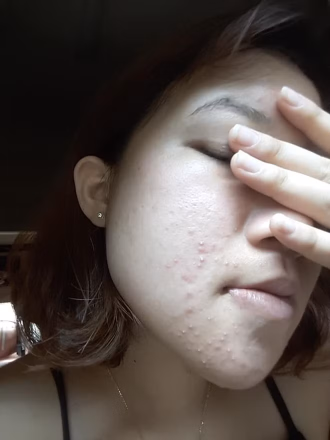 Bùi Thị Huỳnh Mai đến từ Đồng Nai chính là một điển hình như vậy. Cô bạn sở hữu hành trình lột xác khiến ai nấy đều trầm trồ ngưỡng mộ.