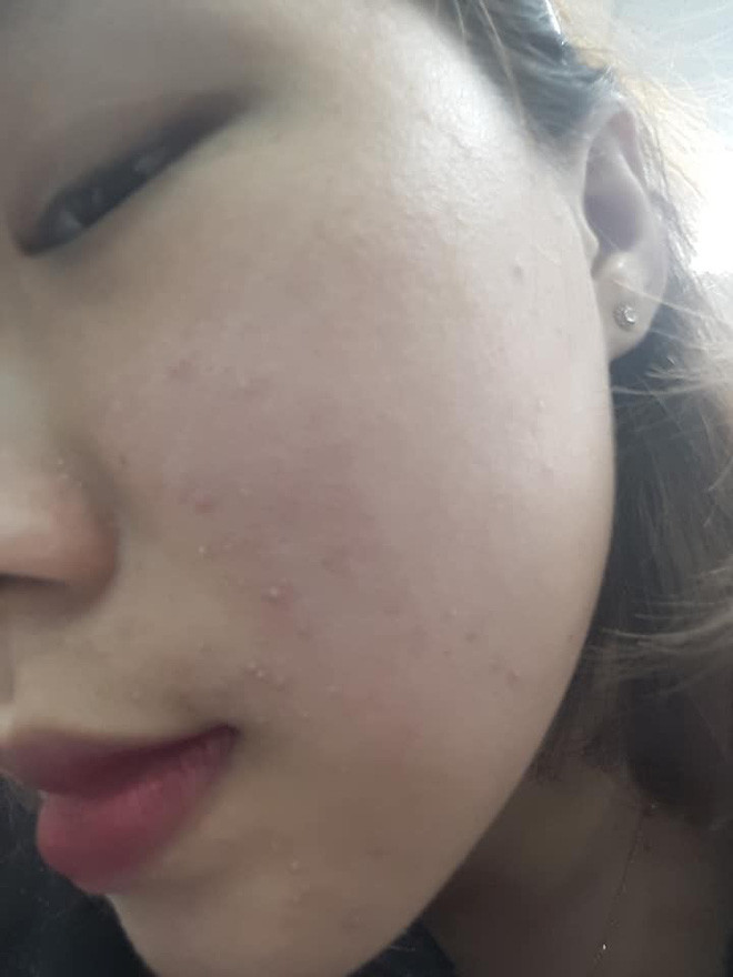 Trước đây, Huỳnh Mai cũng từng có quá khứ bị lôi ra làm chủ đề trêu chọc của nhiều người, thậm chí còn bị... xua đuổi. Lý do là bởi khi ấy cô nàng vừa mập vừa đen, mặt mũi còn đầy mụn.