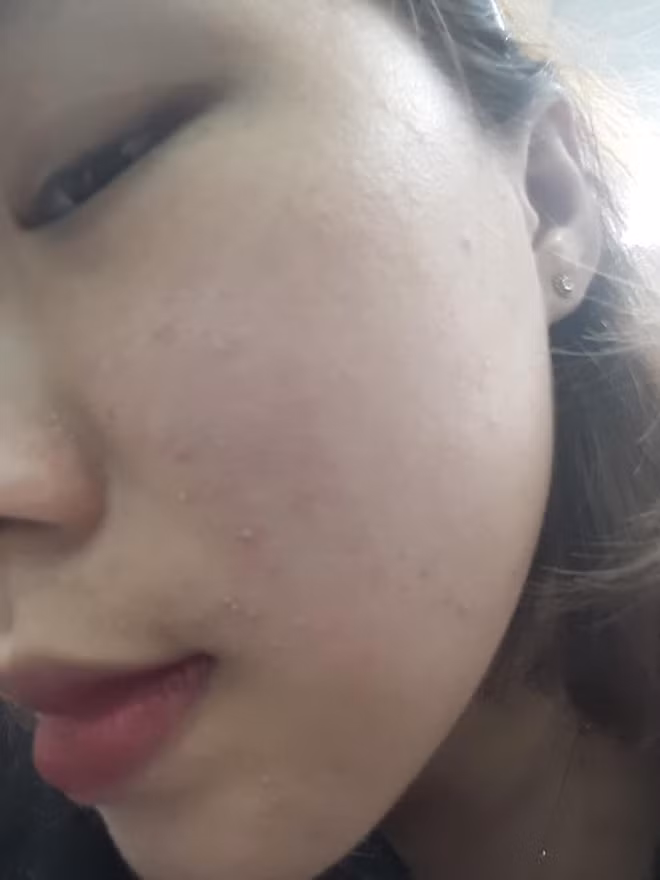 Trước đây, Huỳnh Mai cũng từng có quá khứ bị lôi ra làm chủ đề trêu chọc của nhiều người, thậm chí còn bị... xua đuổi. Lý do là bởi khi ấy cô nàng vừa mập vừa đen, mặt mũi còn đầy mụn.