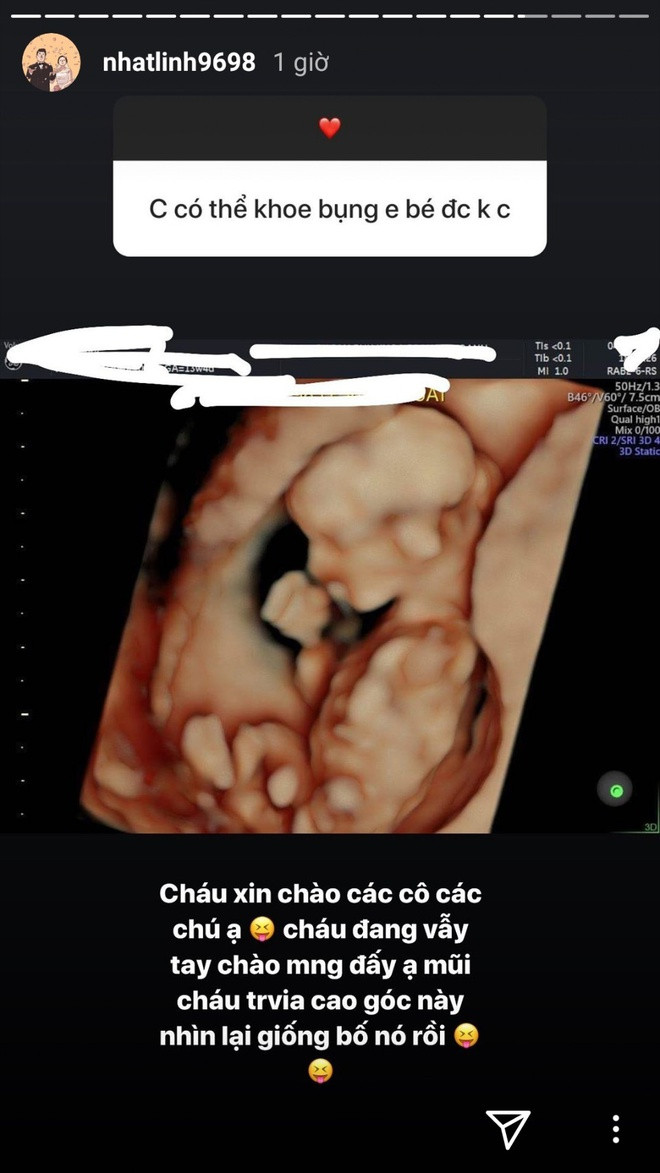 Bên cạnh những chia sẻ về cuộc sống hôn nhân, Nhật Linh cũng hé lộ hình ảnh của con qua bức hình siêu âm. Em bé trộm vía khoẻ mạnh lại sở hữu mũi cao giống hệt bố.