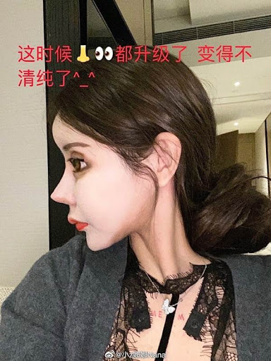 "Trông cô ta như người ngoài hành tinh trong phim viễn tưởng Mỹ vậy, thật kinh khủng", "Đây đâu còn là con người nữa? Tôi thấy gương mặt trước kia của cô ấy còn dễ nhìn hơn. Ai có thể định nghĩa cái đẹp giúp tôi?" - Dân mạng Trung Quốc ác ý bình luận.