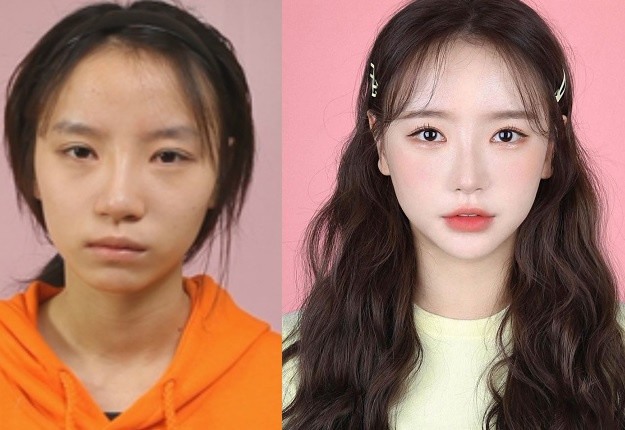 Cô nàng cũng là số ít các hot girl Hàn dám công khai thừa nhận từng dao kéo để sở hữu được nhan sắc như hiện nay.