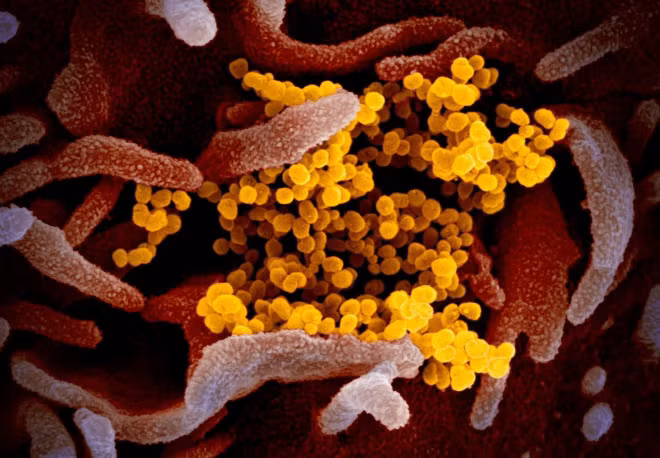 Tiet lo hinh anh chan thuc cua Covid-19 nam giua te bao nguoi