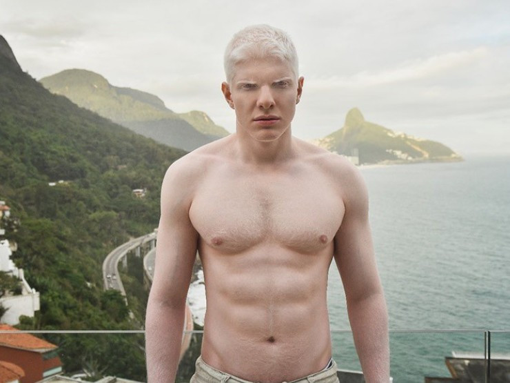 Sở hữu những đặc điểm cơ thể khác biệt như mái tóc, lông mày, thậm chí cả lông mi trắng muốt, mỹ nam đang phá vỡ các tiêu chuẩn sắc đẹp khi chấp nhận căn bệnh bạch tạng và tự hào về con người của mình.