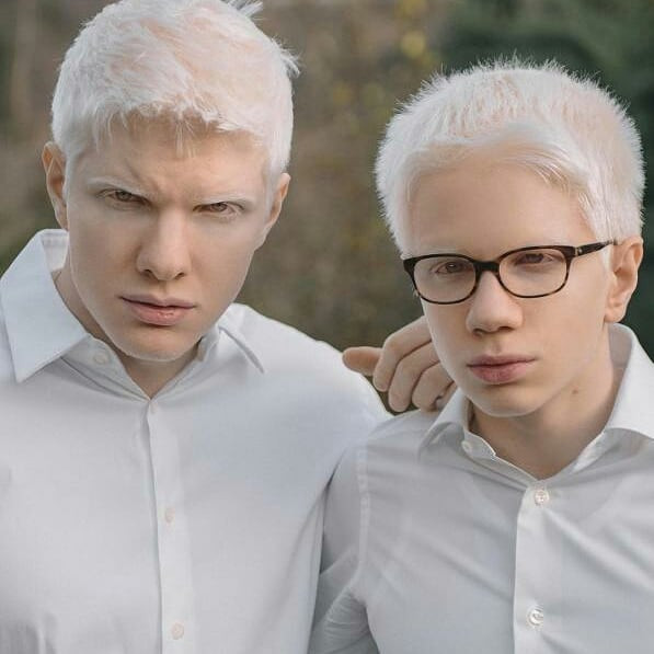 Sự xuất hiện của anh với công việc người mẫu được cho là truyền cảm hứng, là nguồn động lực để những người có ngoại hình khác biệt như anh tự tin hơn.