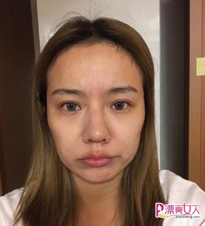 Thay vì im lặng và "mất hút" trên mạng xã hội như bao cô gái khác, hot girl lộ mặt mộc Hiểu dao lại lựa chọn cách thừa nhận nhan sắc thật có phần tầm thường của mình và cho biết bản thân biết tiếp thu ý kiến của mọi người.