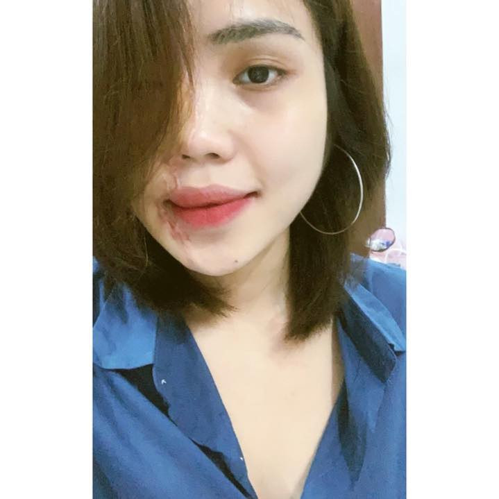 Hiện tại, Lan Vy gây ấn tượng với nụ cười thường trực trên môi, vẻ ngoài rạng rỡ và tinh thần lạc quan.