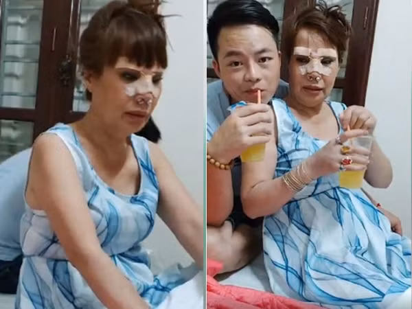 " Cô dâu 62 tuổi" - Thu Sao thời gian vừa qua khiến dân tình xôn xao khi tiếp tục chi 50 triệu tân trang nhan sắc nhằm níu kéo tuổi thanh xuân của mình.