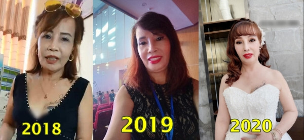 Từ khi lấy chồng trẻ 26 tuổi vào năm 2018, sau hai năm trở thành vợ người ta, cô Thu Sao đã trải qua đến 4-5 lần tân trang khuôn mặt để có được nhan sắc như hiện tại.