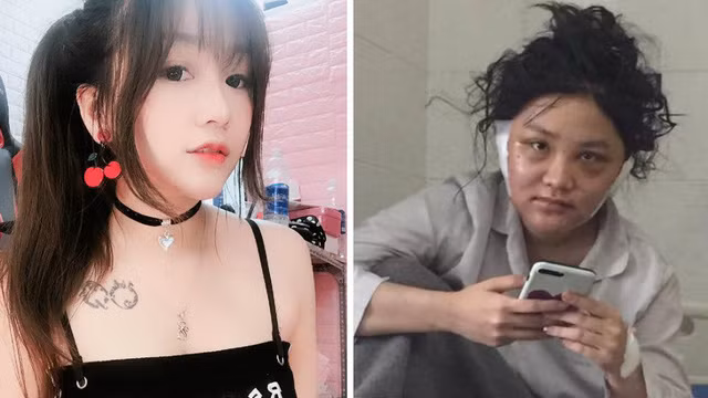 Sau những rùm beng nhạy cảm, Kiều Anh Hera dường như biến mất khỏi mạng xã hội. Sau đó cô bất ngờ lộ những hình ảnh xấu xí trong viện. Được biết cô đi tân trang lại nhan sắc trước khi trở lại với công việc streamer.