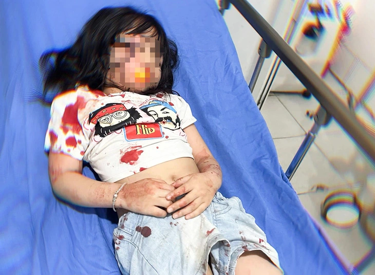 Bé gái trọng thương, chảy nhiều máu do bị chó cắn. Mới tháng trước thôi, sự việc nam sinh Hoàng V (trường Cao đẳng Du lịch Lào Cai) bị 2 con chó thả rông cắn thương tích nặng vào chiều 18/2 vẫn để lại ấn tượng đáng sợ trong lòng nhiều người. Kể về phút kinh hoàng bị hai con chó thả rông tấn công, V. cho biết, khi ấy em đang chạy bộ tập thể dục một mình thì gặp 2 con chó dữ có ý định tấn công. V. lấy dép xua đuổi nhưng hai con chó không đi và lao vào cắn. Nam sinh này cố bỏ chạy nhưng không thoát được và bị cắn vào tay, chân. Sau đó, V. bị quật ngã, bị cắn vào sau gáy. Cố vùng vẫy, V. kiệt sức, không phản kháng được và bị ngã quỵ không kêu được nữa. May mắn, V. được người dân phát hiện, chạy đến cứu. Sau đó, nam sinh đã được đưa đến điều trị tại khoa Ngoại chấn thương, bệnh viện Đa khoa tỉnh Lào Cai.