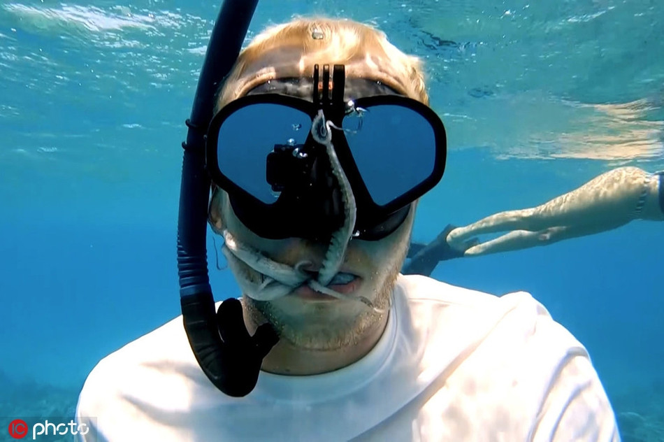 Het hon bach tuoc chui vao mieng tho lan lam nha si-Hinh-4