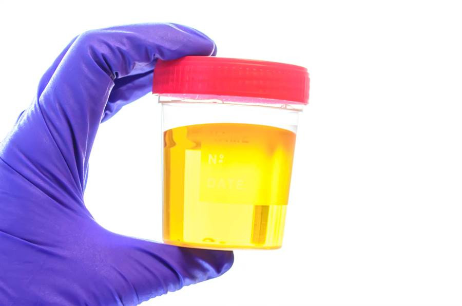 Hoa ra nuoc tieu voi nguoi La ma co dai 