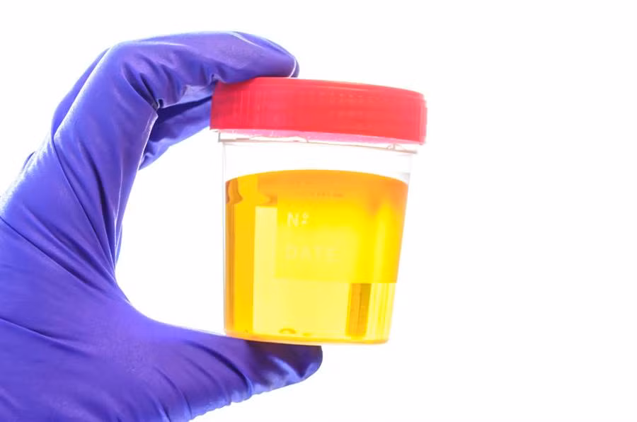 Hoa ra nuoc tieu voi nguoi La ma co dai 