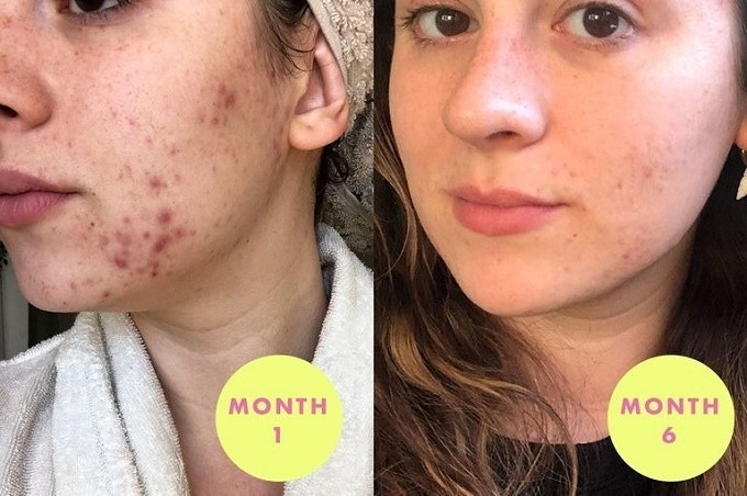 An cac loai hat quen thuoc nay theo chu ky, mun noi tiet bay sach-Hinh-4