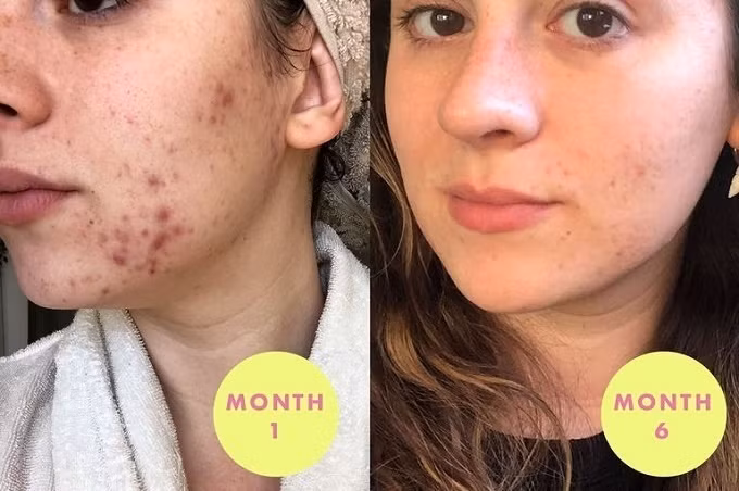 An cac loai hat quen thuoc nay theo chu ky, mun noi tiet bay sach-Hinh-4