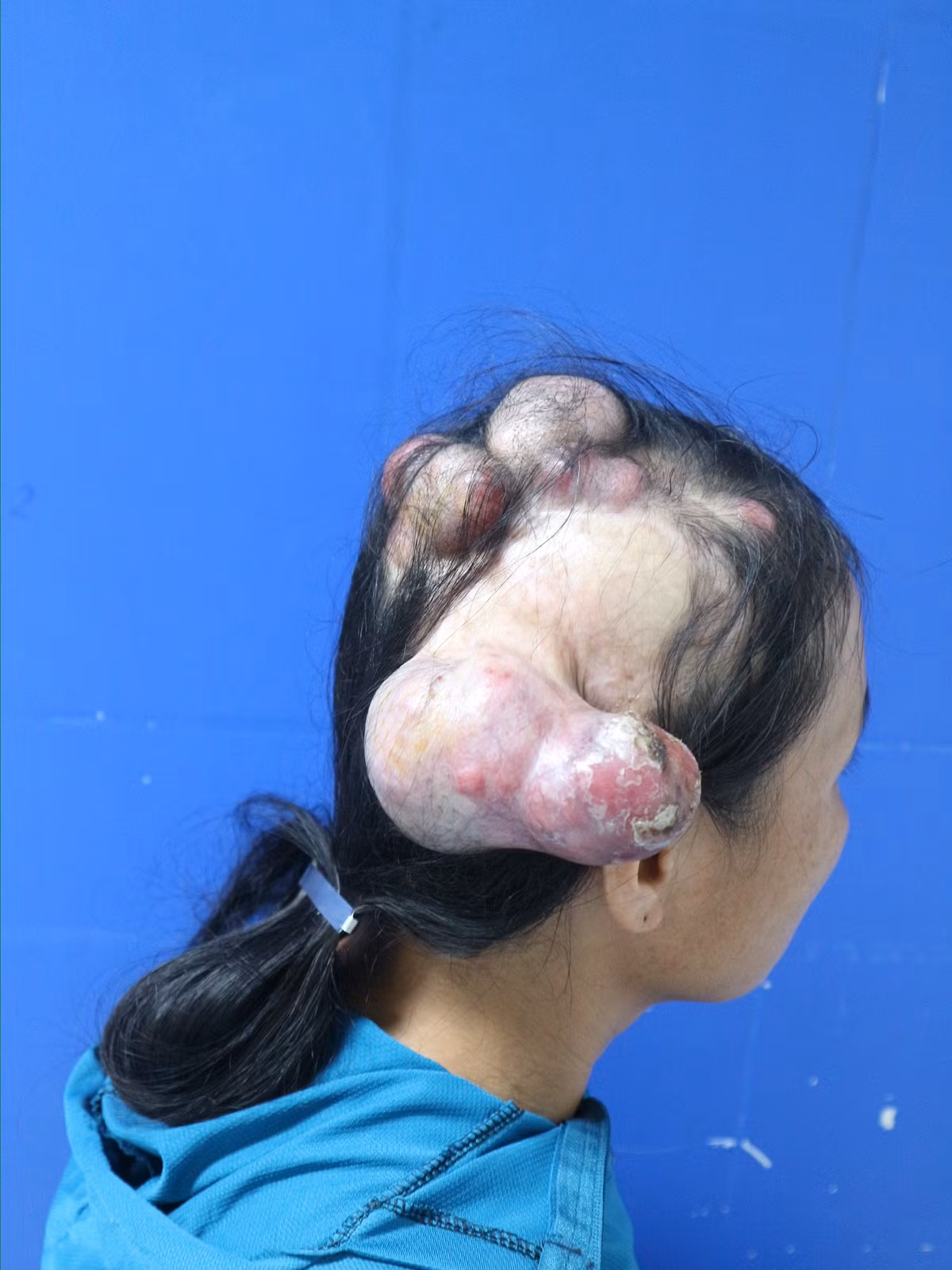 Can benh khien nguoi phu nu 