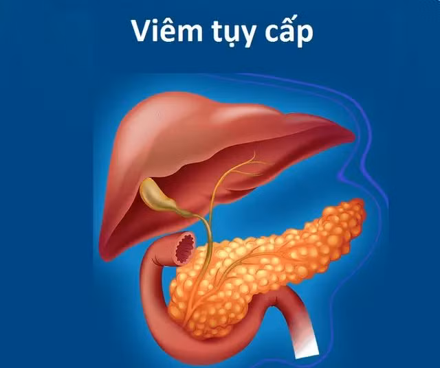 Máu trắng đục như sữa vì ăn uống vô độ, mắc bệnh gì? Mau trang duc nhu sua vi an uong vo do, mac benh gi?