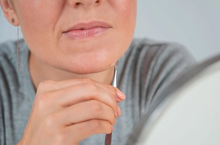  Rậm lông và rụng tóc: Theo Cleveland Clinic, PCOS có thể gây ra tình trạng mọc lông quá mức trên mặt và cơ thể, hay còn gọi là rậm lông, cũng như khiến tóc mỏng đi trên da đầu. Các triệu chứng này là hệ quả của nồng độ hormone nam (androgen) cao trong cơ thể. Lông phát triển quá mức có thể xuất hiện ở các khu vực như khuôn mặt, cổ, ngực, bụng, lưng dưới và đùi. Ảnh: Fertilityfamily.