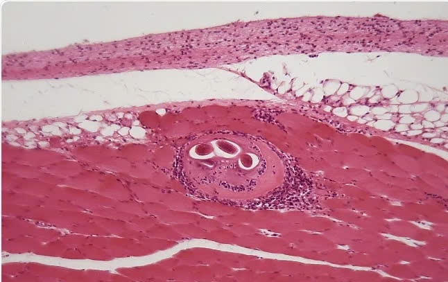 Giun xoắn thường gặp trong thịt lợn tái. Ảnh: ChWeiss/ Shutterstock.