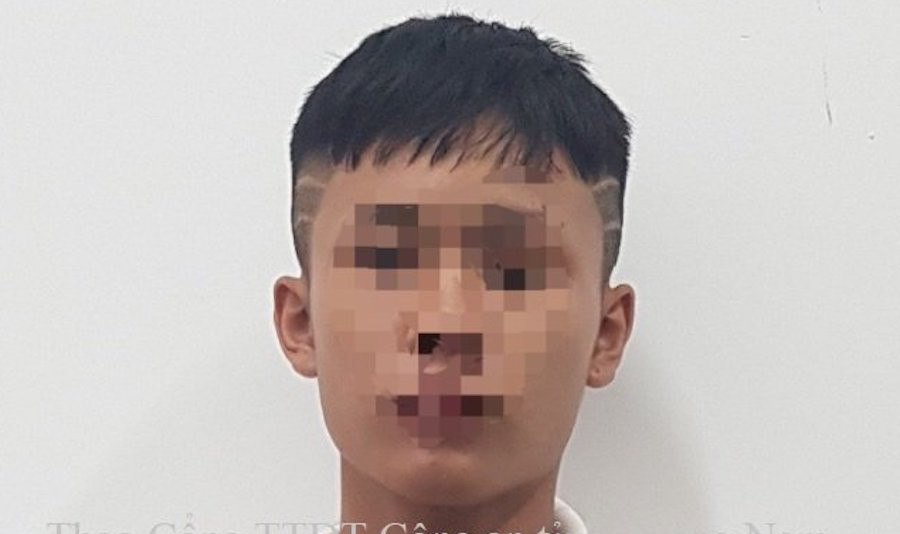  Cụ bà 83 tuổi bị cướp kẹp cổ giật dây chuyền vàng: N.D.H (16 tuổi, ngụ huyện Quế Sơn, Quảng Nam) đột nhập nhà cụ Phạm Thị Tư (83 tuổi, trú cùng địa phương) rồi dùng tay bóp cổ, giật sợi dây chuyền vàng cụ đang đeo rồi bỏ trốn. Ngày 3/9, Công an huyện Quế Sơn đã giữ người trong trường hợp khẩn cấp đối với H. 